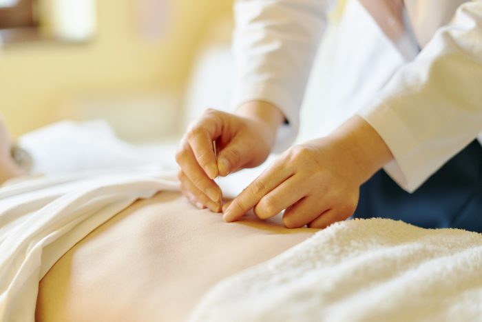 腰の鍼治療